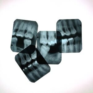 x-ray of teeth