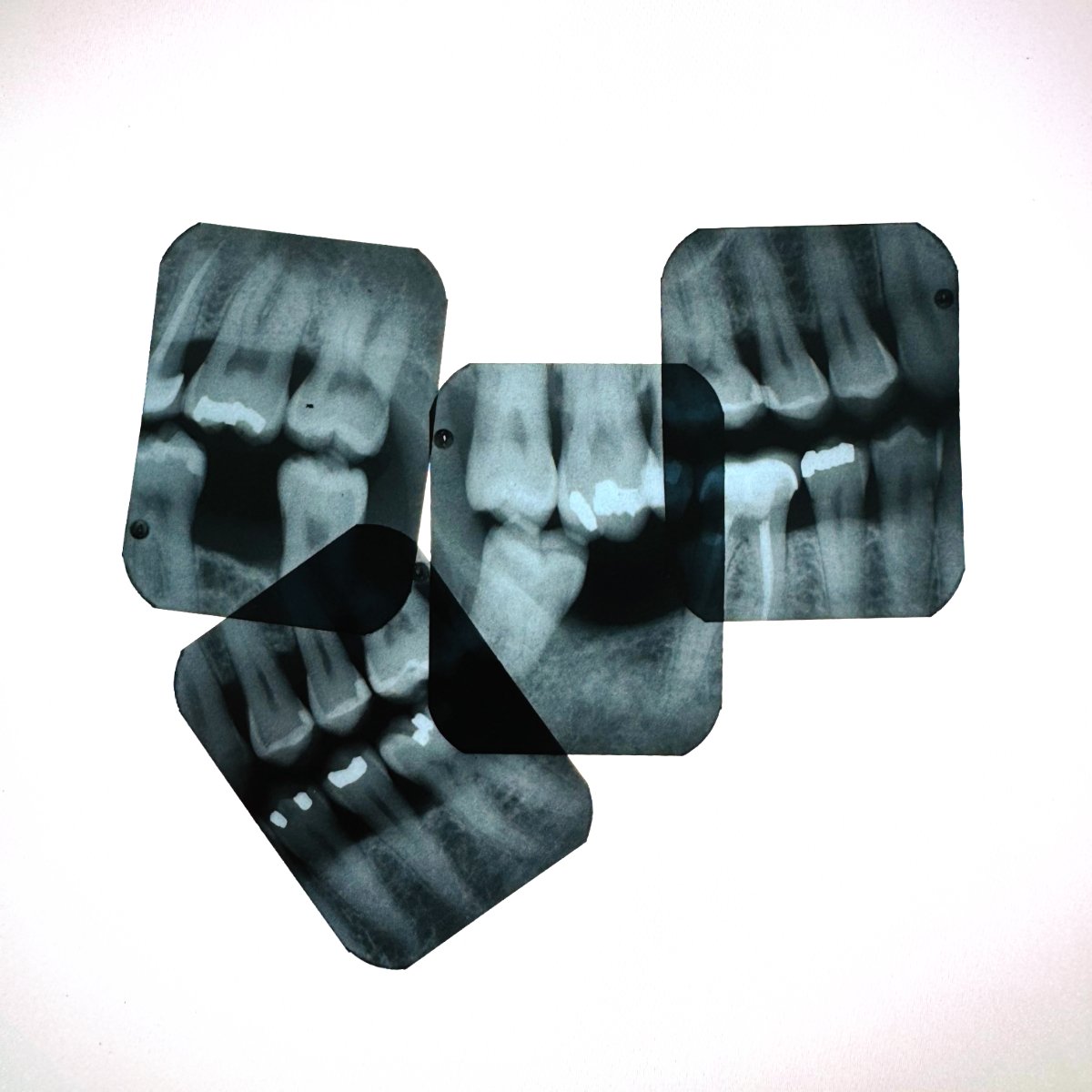 Dental X-ray imaging film
