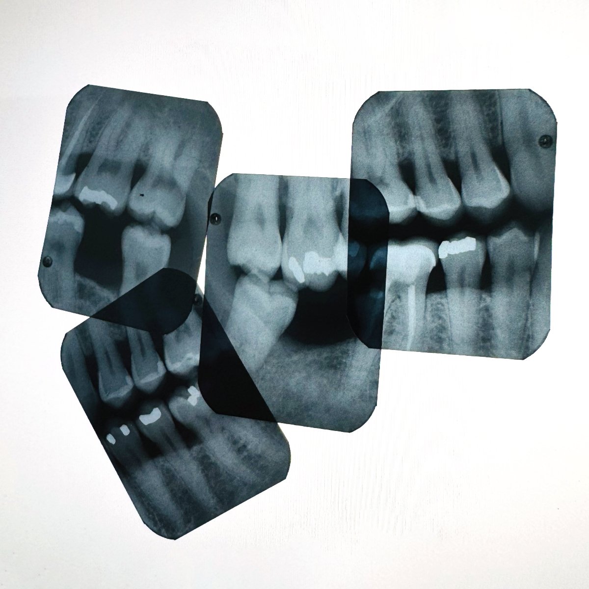 X-Ray Destruction