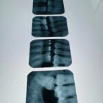 Dental X-ray film for secure shredding in Eagle, ID